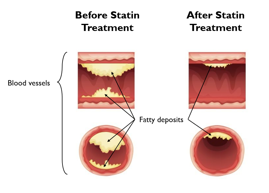 statins effect on blood vessels